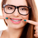 Different Styles of Braces Makes Choosing Hard