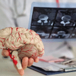 neurology Hospital in hyderabad