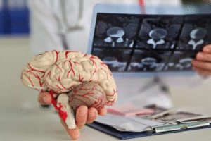 neurology Hospital in hyderabad