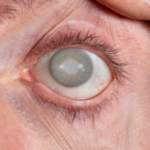 best eye hospital in Coimbatore