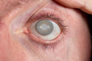 best eye hospital in Coimbatore